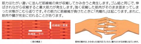 肉離れの起こり方として、筋繊維に平行に切れるものと垂直方向にきれるものがあるらしい（白い線で表してみました）