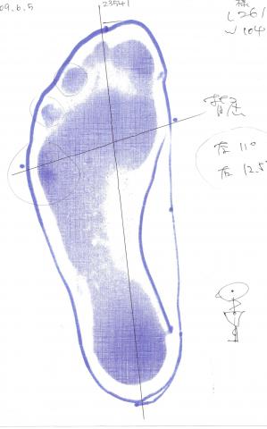 左足のフットプリント　色が濃い所が圧力が高い。小指の下が濃くなっており、圧力が外に逃げる傾向にある。　左11.0　右12.5と書いてあるのは足首の屈曲性。ランナーは最低15度は欲しいと言われた。