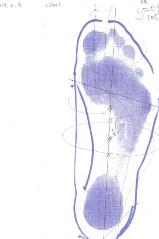 右足のフットプリント　土踏まずがほとんどついていない。非常に狭い面積で支えているため不安定になりやすい。重心を後ろに調整する必要があると、下向きの矢印が描かれている。