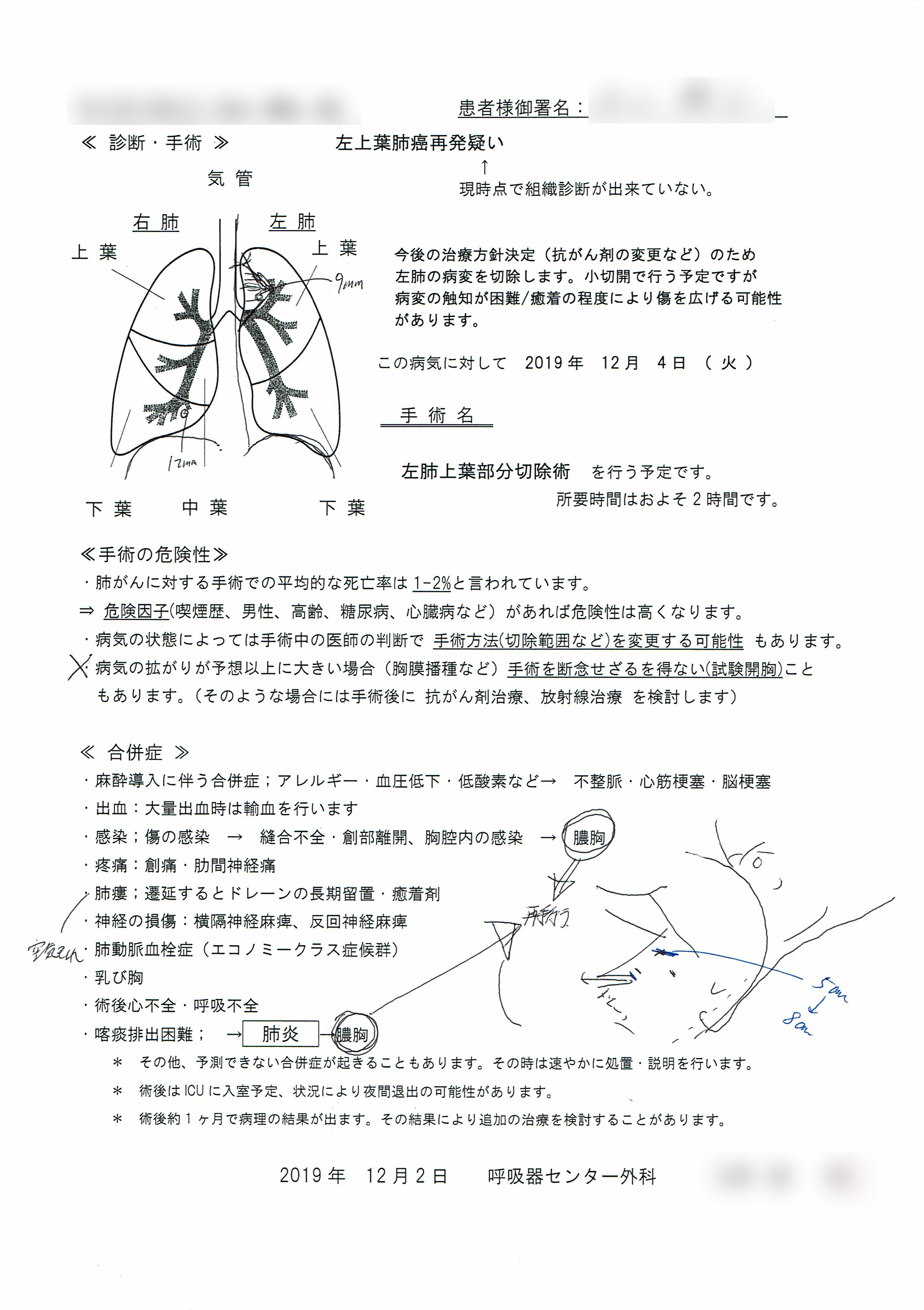 手術内容の説明