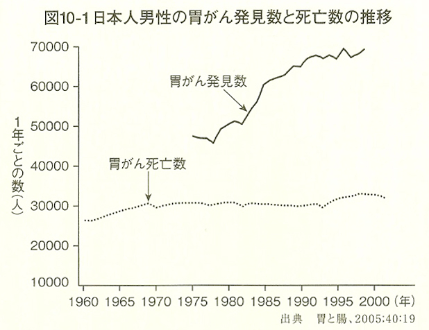 日本人男性の胃がん発見数と死亡数の推移