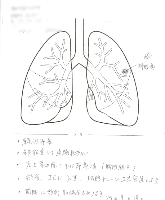 手術の事前説明