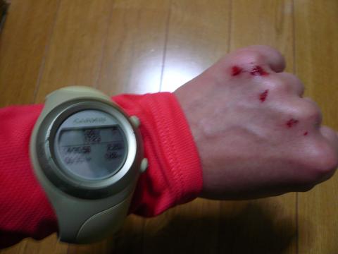 ちょっとピンボケですけど、大事なガーミンに傷がついてるのわかりますか？機能的には問題ないようなので良かった～。