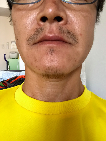405復活