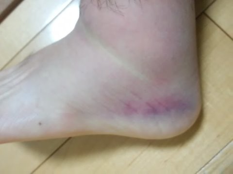 見苦しくてすみません^^;