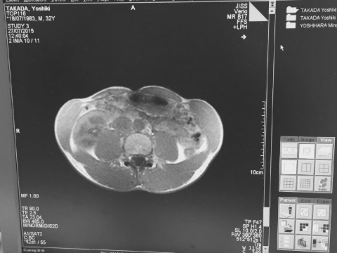 40㎞とMRI