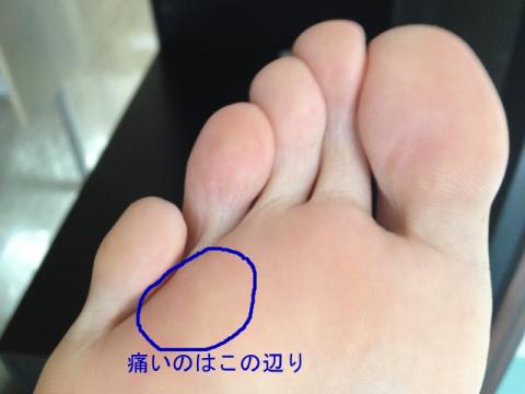 汚い画像でスミマセン